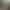 فقر حرکتی: کمبود فعالیت جسمانی لازم که خطر اضافه‌وزن، ضعف عضلانی و مشکلات سلامتی را افزایش می‌دهد.